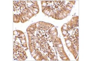 Immunohistochemistry of ZBP1 in human small intestine tissue with ZBP1 antibody at 2. (ZBP1 抗体  (C-Term))