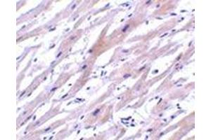 Immunohistochemistry of UNG1 in human heart tissue with this product at 2 μg/ml. (UNG 抗体  (N-Term))