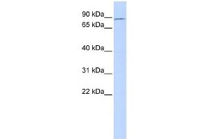 WB Suggested Anti-TBX2 Antibody Titration:  0. (TBX2 抗体  (Middle Region))