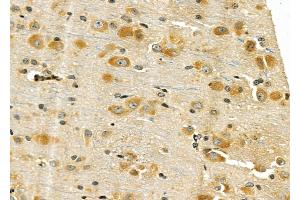 ABIN6258799 and ABIN6275949 at 1/100 staining Rat brain tissue by IHC-P. (GPR176 抗体  (C-Term))