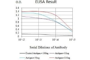 Black line: Control Antigen (100 ng),Purple line: Antigen (10 ng), Blue line: Antigen (50 ng), Red line:Antigen (100 ng) (Topoisomerase II alpha 抗体  (AA 1100-1530))