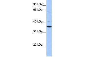 WB Suggested Anti-CNN2 Antibody Titration: 0. (CNN2 抗体  (N-Term))