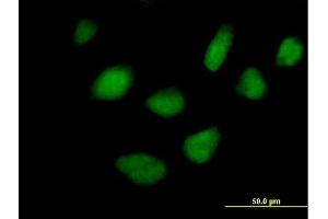 Immunofluorescence of purified MaxPab antibody to STK36 on HeLa cell. (STK36 抗体  (AA 1-1315))