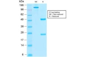 SDS-PAGE (SDS) image for anti-Thrombomodulin (THBD) (AA 69-194) antibody (ABIN5707539)