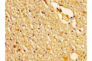IHC image of ABIN7160954 diluted at 1:200 and staining in paraffin-embedded human brain tissue performed on a Leica BondTM system. (NDUFS2 抗体  (AA 297-427))