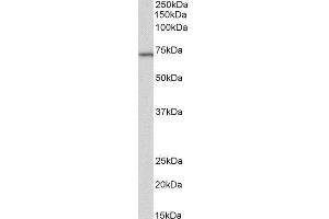 ABIN2560413 (2µg/ml) staining of Daudi lysate (35µg protein in RIPA buffer). (TICAM1 抗体)