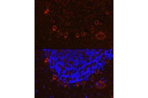 Immunofluorescence analysis of mouse brain cells using  Rabbit pAb (ABIN6131182, ABIN6136830, ABIN6136831 and ABIN6222940) at dilution of 1:100 (40x lens). (ALS2 抗体  (AA 1-280))