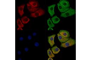 Phospho-Paxillin (Ser178) Antibody staining Hela cells(heat shock treatment) by IF/ICC. (Paxillin 抗体  (pSer178))