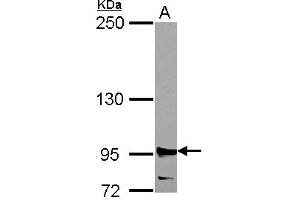 Western Blotting (WB) image for anti-Ribonucleotide Reductase M1 (RRM1) (AA 246-792) antibody (ABIN1500769) (RRM1 抗体  (AA 246-792))