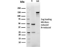 SDS-PAGE Analysis Purified GLUT-1 Recombinant Mouse Monoclonal Antibody (rGLUT1/2476). (Recombinant GLUT1 抗体  (AA 203-305))