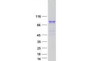 Western Blotting (WB) image for Calcium Channel, Voltage-Dependent, beta 1 Subunit (CACNB1) (Transcript Variant 1) protein (Myc-DYKDDDDK Tag) (ABIN2713007)