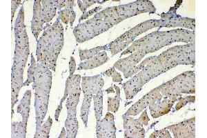 IHC analysis of Dnmt1 using anti-Dnmt1 antibody . (DNMT1 抗体  (AA 22-126))