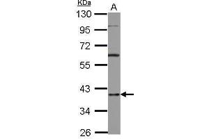 WB Image Sample (30 ug of whole cell lysate) A: A431 10% SDS PAGE antibody diluted at 1:1000 (HNRNPD/AUF1 抗体)