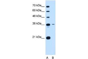 Tetraspanin 5 antibody used at 0. (Tetraspanin 5 抗体  (Middle Region))