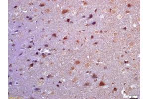 Formalin-fixed and paraffin embedded rat brain labeled with Anti-TSSC3 Polyclonal Antibody, Unconjugated (ABIN872459) at 1:200 followed by conjugation to the secondary antibody and DAB staining