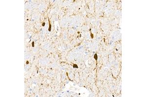 Immunohistochemistry of paraffin-embedded rat brain using DDC Rabbit pAb (ABIN1679510, ABIN3018150, ABIN3018151 and ABIN6220384) at dilution of 1:25 (40x lens).