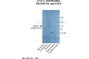 Image no. 1 for anti-Transient Receptor Potential Cation Channel, Subfamily C, Member 3 (TRPC3) (N-Term) antibody (ABIN2787800)