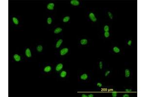 Image no. 3 for anti-DEAD (Asp-Glu-Ala-Asp) Box Polypeptide 54 (DDX54) (AA 778-882) antibody (ABIN599302) (DDX54 抗体  (AA 778-882))