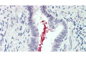 Immunohistochemistry (Paraffin-embedded Sections) (IHC (p)) image for anti-Interleukin 19 (IL19) antibody (ABIN7239077)