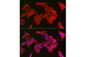 Immunofluorescence (IF) image for anti-Tripartite Motif Containing 21 (TRIM21) (AA 80-330) antibody (ABIN6149506)