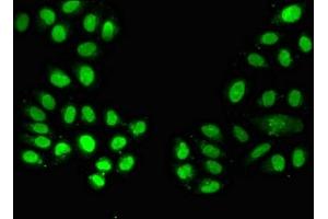 Immunofluorescent analysis of A549 cells using ABIN7161574 at dilution of 1:100 and Alexa Fluor 488-congugated AffiniPure Goat Anti-Rabbit IgG(H+L) (NAMPT 抗体  (AA 1-280))