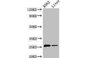 Western Blot Positive WB detected in: K562 whole cell lysate, Mouse liver tissue All lanes: NQO2 antibody at 3 μg/mL Secondary Goat polyclonal to rabbit IgG at 1/50000 dilution Predicted band size: 26 kDa Observed band size: 26 kDa (NQO2 抗体  (AA 1-231))
