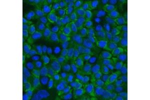 anti-RAN Binding Protein 1 (RANBP1) (AA 2-201) antibody