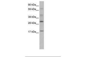 Image no. 1 for anti-PYD and CARD Domain Containing (PYCARD) (AA 71-120) antibody (ABIN202052)