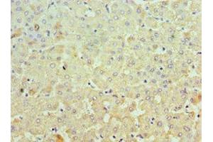 Immunohistochemistry (IHC) image for anti-Minichromosome Maintenance Complex Component 3 (MCM3) (AA 1-295) antibody (ABIN7150332)