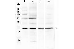 Western blot analysis of Myoglobin using anti-Myoglobin antibody . (MB 抗体  (N-Term))