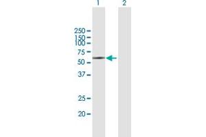 Western Blotting (WB) image for anti-Killer Cell Immunoglobulin-Like Receptor, Two Domains, Long Cytoplasmic Tail, 5A (KIR2DL5A) (AA 1-375) antibody (ABIN949529)