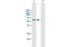 Western Blot analysis of KIR2DL5A expression in transfected 293T cell line by KIR2DL5A MaxPab polyclonal antibody. (KIR2DL5A 抗体  (AA 1-375))