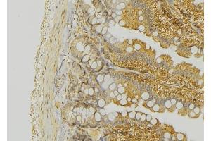 ABIN6276324 at 1/100 staining Mouse colon tissue by IHC-P. (KRT20 抗体  (C-Term))