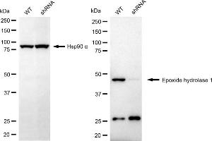 anti-Epoxide Hydrolase 1, Microsomal (Xenobiotic) (EPHX1) antibody