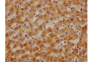 IHC image of ABIN7148519 diluted at 1:200 and staining in paraffin-embedded human liver tissue performed on a Leica BondTM system. (Copine III 抗体  (AA 297-442))
