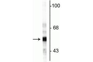 Western blot of rat cerebellar lysate showing specific immunolabeling of the ~57 kDa peripherin protein. (Peripherin 抗体)