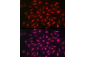 Immunofluorescence analysis of U2OS cells using KPNB1 Rabbit pAb (ABIN6134722, ABIN6142997, ABIN6142998 and ABIN6224723) at dilution of 1:100 (40x lens). (KPNB1 抗体  (AA 250-350))