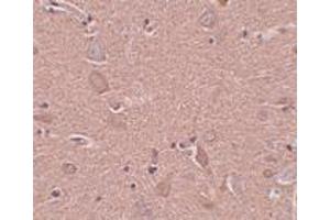 Immunohistochemistry (IHC) image for anti-Sushi-Repeat Containing Protein, X-Linked (SRPX) (N-Term) antibody (ABIN1031585) (SRPX 抗体  (N-Term))