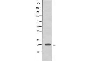 Western blot analysis of extracts from HeLa cells using RPL10L antibody.