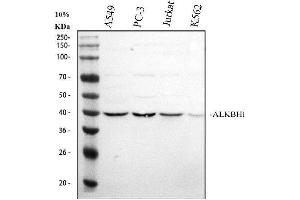Western blot analysis of ALKBH1 using anti-ALKBH1 antibody (ABIN7602742).