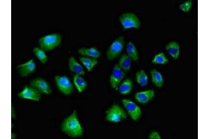 Immunofluorescent analysis of A549 cells using ABIN7170645 at dilution of 1:100 and Alexa Fluor 488-congugated AffiniPure Goat Anti-Rabbit IgG(H+L) (SPRED1 抗体  (AA 123-311))