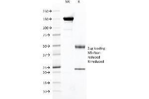 SDS-PAGE Analysis Purified FOLH1 Mouse Monoclonal Antibody (FOLH1/2121). (PSMA 抗体  (AA 232-433))