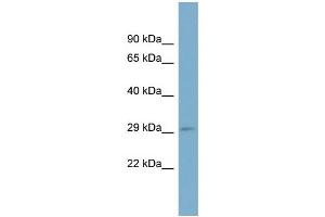 WB Suggested Anti-RAB23 Antibody Titration: 0. (RAB23 抗体  (N-Term))