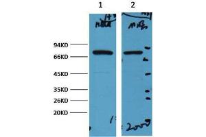 Western Blot (WB) analysis of 1) HeLa, 2) Mouse Brain, diluted at 1:2000. (HSP70 抗体)
