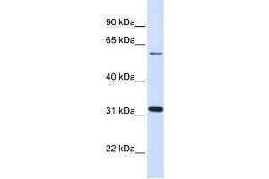 LGALS3 antibody used at 1 ug/ml to detect target protein. (Galectin 3 抗体  (N-Term))