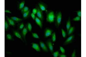 Immunofluorescence staining of Hela cells with ABIN7145788 at 1:66, counter-stained with DAPI. (BRE 抗体  (AA 94-383))