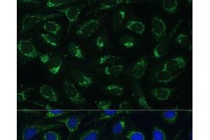 Immunofluorescence analysis of U-2 OS cells using ETFB Polyclonal Antibody at dilution of 1:100 (40x lens). (ETFB 抗体)