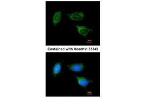 ICC/IF Image Immunofluorescence analysis of methanol-fixed HeLa, using ATP synthase B1, antibody at 1:200 dilution. (ATP Synthase B1 (Center) 抗体)