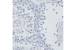 Immunohistochemistry of paraffin-embedded rat testis using MSH6 antibody (ABIN7268710) at dilution of 1:100 (40x lens).