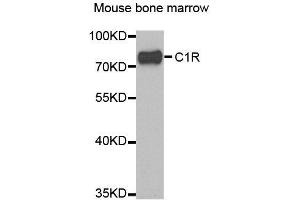 Western blot analysis of extracts of mouse bone marrow, using C1R antibody. (C1R 抗体)